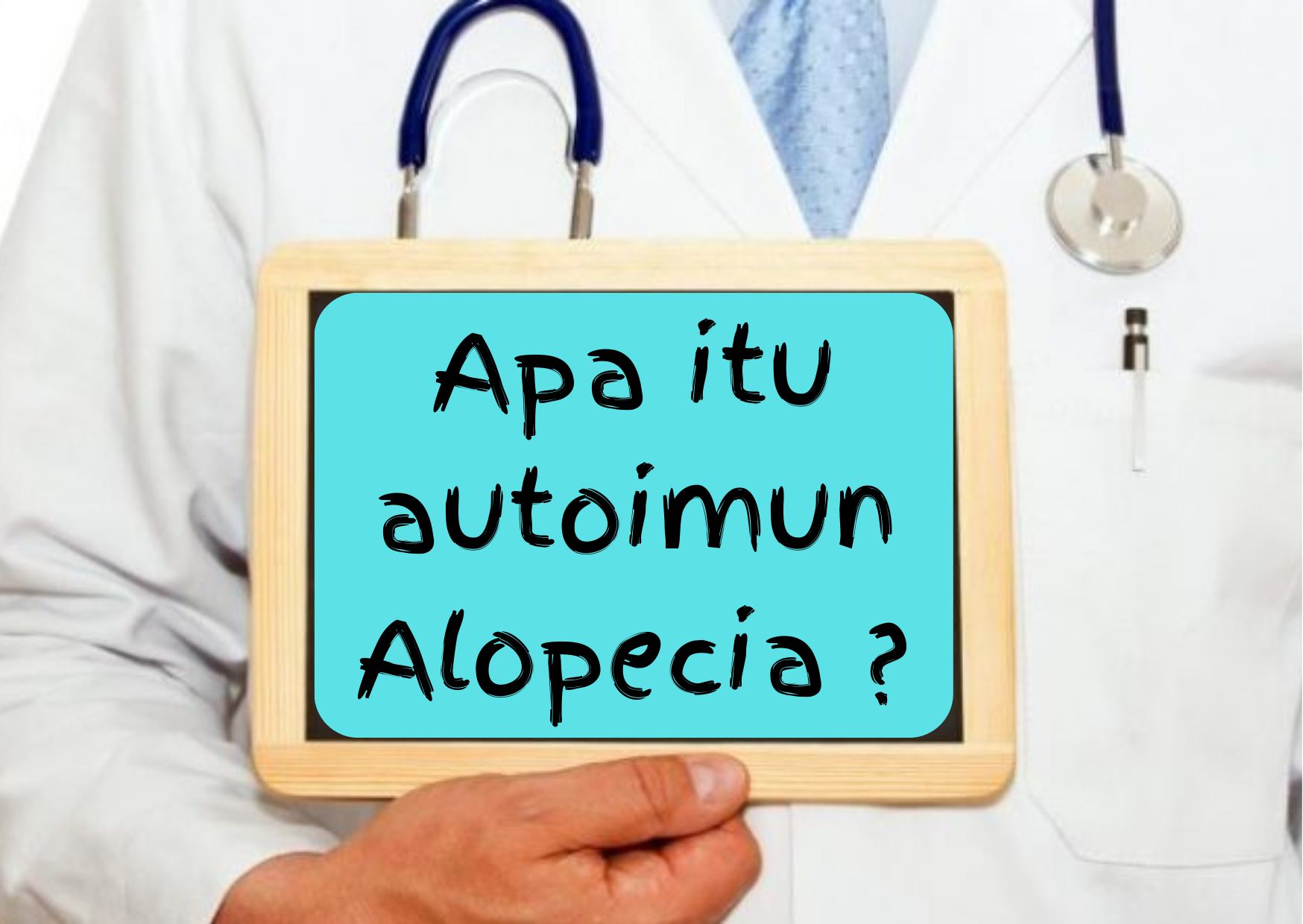 Apa itu Alopecia ?